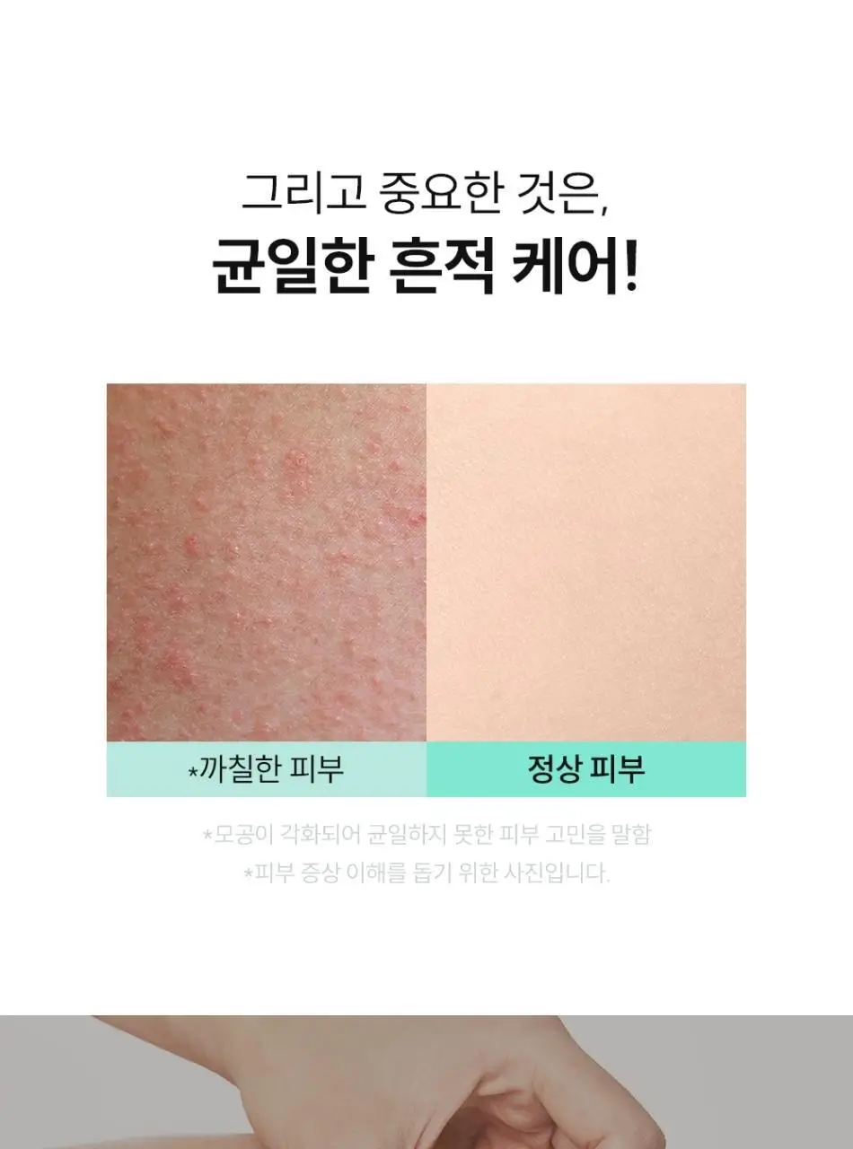 [피부결/각질케어] 낫포유 닭살/모공각화 매끈 바디 미스트 115ml 상세페이지 10